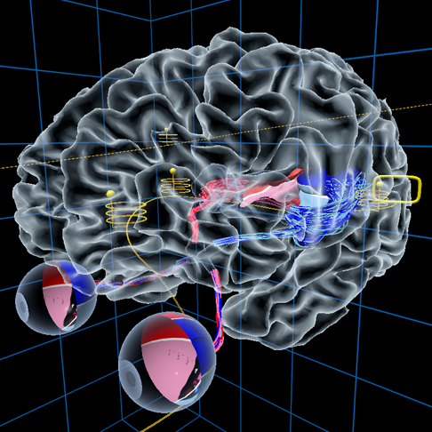 UW Virtual Brain Project™ 